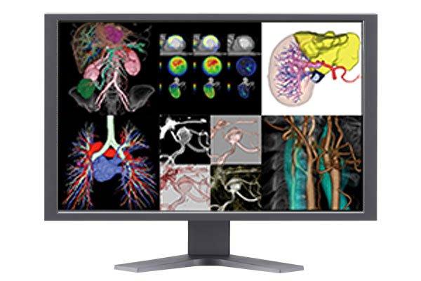 Synapse® 3D by Fujifilm (manufacturer image)
