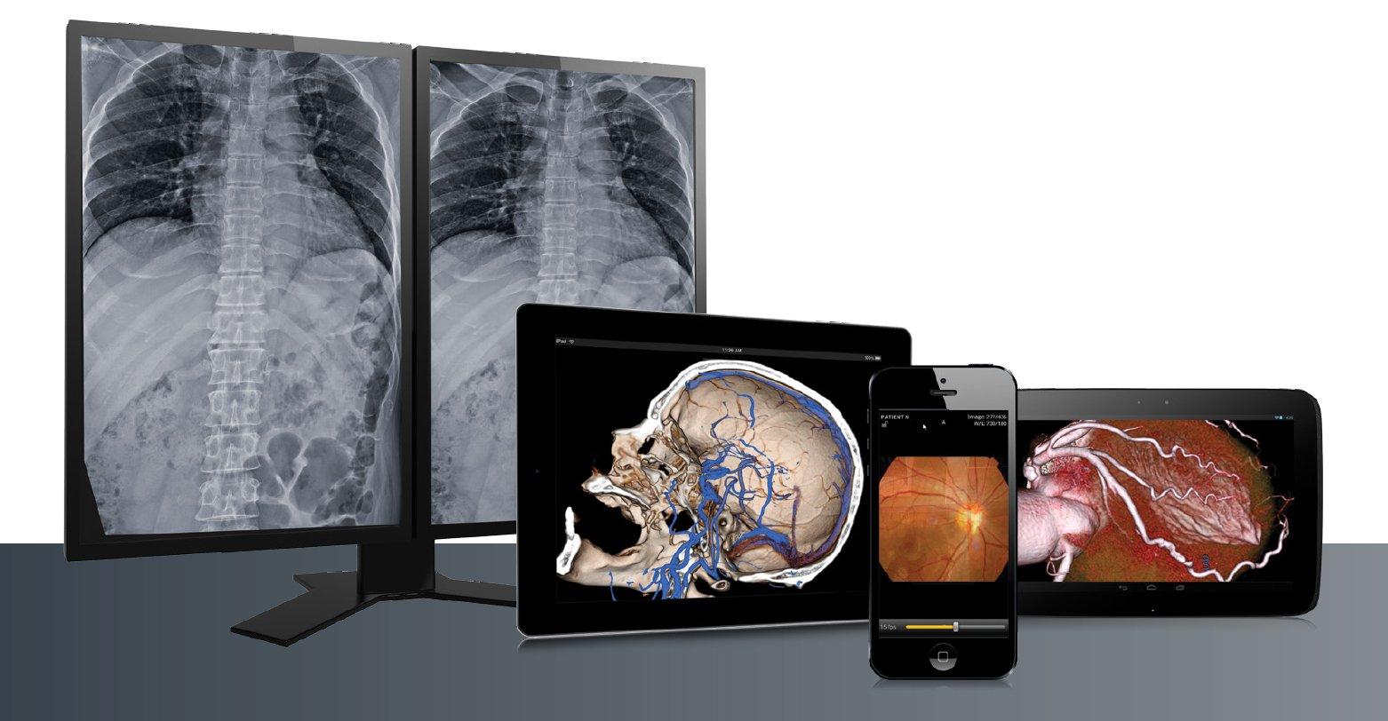 Synapse® VNA by Fujifilm (manufacturer image)