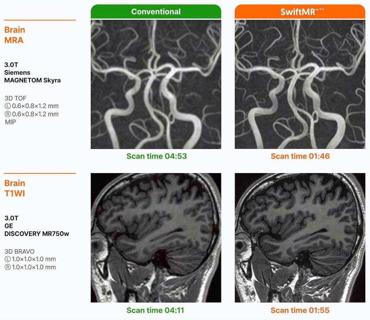 SwiftMR™ comparison image, via Vertex in Healthcare (manufacturer image)
